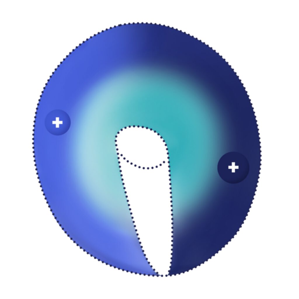 Defokuszone